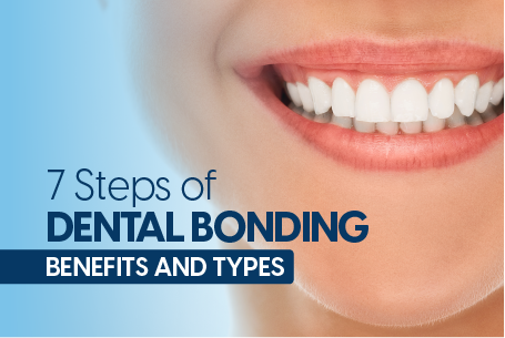 7 Steps Of Dental Bonding: Benefits And Types | Berkers Family Dental