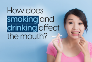 Daily Tips To Prevent Cavities 3