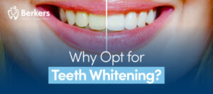 Home 8 Teeth Whitening